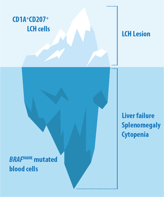 Preclinial models for LCH 